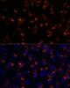 Cell Biology Antibodies 6 Anti-CCDC47 Antibody CAB15871