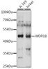 Cell Biology Antibodies 6 Anti-WDR18 Antibody CAB15875