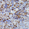 Cell Biology Antibodies 6 Anti-MMP25 Antibody CAB15886