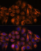 Cell Biology Antibodies 6 Anti-MMP25 Antibody CAB15886