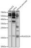 Metabolism Antibodies 3 Anti-PLA2G12A Antibody CAB15902