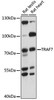 Cell Death Antibodies 1 Anti-TRAF7 Antibody CAB15912