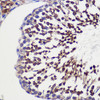 Cell Biology Antibodies 6 Anti-TUBGCP6 Antibody CAB15921
