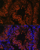 Cell Biology Antibodies 6 Anti-FER1L5 Antibody CAB15926