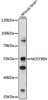 Cell Biology Antibodies 6 Anti-NOSTRIN Antibody CAB15938