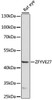 Cell Biology Antibodies 6 Anti-ZFYVE27 Antibody CAB15942