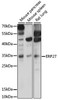 Signal Transduction Antibodies 2 Anti-ERP27 Antibody CAB15944