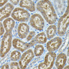 Autophagy Antibodies Anti-C9orf72 Antibody CAB15970