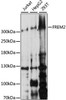 Cell Biology Antibodies 6 Anti-FREM2 Antibody CAB15980