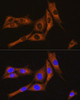 Cell Biology Antibodies 6 Anti-GNAT3 Antibody CAB15982