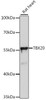 Epigenetics and Nuclear Signaling Antibodies 2 Anti-TBX20 Antibody CAB15994