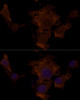 Immunology Antibodies 2 Anti-TSC2 Antibody CAB16007