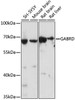 Signal Transduction Antibodies 2 Anti-GABRD Antibody CAB16016