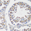 Cell Cycle Antibodies 1 Anti-Cyclin B1 Antibody CAB16038