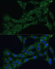 Cell Biology Antibodies 6 Anti-ETFB Antibody CAB16043