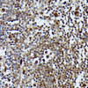Cell Biology Antibodies 6 Anti-MAP3K3 Antibody CAB16058