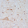 Neuroscience Anti-SLC18A3 Antibody CAB16068