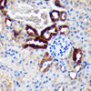 Cell Biology Antibodies 6 Anti-EML4 Antibody CAB16117