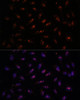 Epigenetics and Nuclear Signaling Antibodies 2 Anti-DNTTIP2 Antibody CAB16120