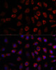 Signal Transduction Antibodies 2 Anti-PDE11A Antibody CAB16121
