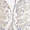 Cell Biology Antibodies 6 Anti-WBSCR27 Antibody CAB16176