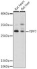 Cell Biology Antibodies 6 Anti-YIPF7 Antibody CAB16180
