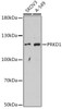 Cardiovascular Antibodies Anti-PRKD1 Antibody CAB16185