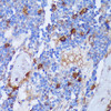 Immunology Antibodies 2 Anti-PADI4 Antibody CAB16188