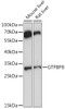 Cell Biology Antibodies 6 Anti-GTPBP8 Antibody CAB16189