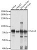 Epigenetics and Nuclear Signaling Antibodies 2 Anti-SALL4 Antibody CAB16193