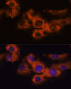 Cell Biology Antibodies 6 Anti-NDRG4 Antibody CAB16195