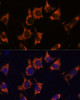 Cell Biology Antibodies 6 Anti-NDRG4 Antibody CAB16195