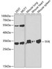 Cardiovascular Antibodies Anti-TFPI Antibody CAB1624