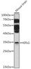 Cell Biology Antibodies 6 Anti-KITLG Antibody CAB16245