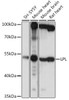 Metabolism Antibodies 3 Anti-LPL Antibody CAB16252