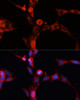 Cell Biology Antibodies 6 Anti-SMPD1 / ASM Antibody CAB16263