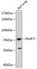 Epigenetics and Nuclear Signaling Antibodies 2 Anti-NUR77 Antibody CAB16264