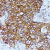 Cell Biology Antibodies 6 Anti-DDX6 Antibody CAB16270