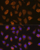 Signal Transduction Antibodies 2 Anti-VHL Antibody CAB16287