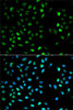 Signal Transduction Antibodies 2 Anti-DTNBP1 Antibody CAB1632