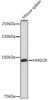 Metabolism Antibodies 2 Anti-HMGCR Antibody CAB1633