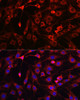 Metabolism Antibodies 2 Anti-HMGCR Antibody CAB1633