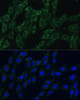 Epigenetics and Nuclear Signaling Antibodies 2 Anti-AEBP1 Antibody CAB16340