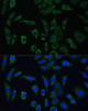 Epigenetics and Nuclear Signaling Antibodies 2 Anti-AEBP1 Antibody CAB16340