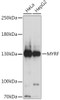 Developmental Biology Anti-MYRF Antibody CAB16355