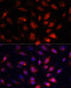 Metabolism Antibodies 2 Anti-ENO3 Antibody CAB16371