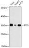 Signal Transduction Antibodies 2 Anti-IFI35 Antibody CAB16384