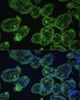 Cell Biology Antibodies 7 Anti-KRT13 Antibody CAB16393