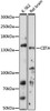 Epigenetics and Nuclear Signaling Antibodies 2 Anti-CIITA Antibody CAB16401