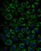 Metabolism Antibodies 2 Anti-MTIF2 Antibody CAB16402